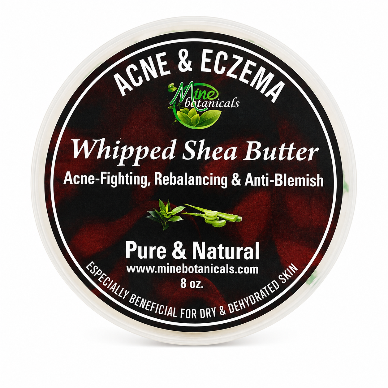 Acne & Eczema Whipped Shea Butter